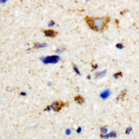 PKMYT1 Antibody - Immunohistochemical analysis of MYT1 staining in human brain formalin fixed paraffin embedded tissue section. The section was pre-treated using heat mediated antigen retrieval with sodium citrate buffer (pH 6.0). The section was then incubated with the antibody at room temperature and detected using an HRP conjugated compact polymer system. DAB was used as the chromogen. The section was then counterstained with hematoxylin and mounted with DPX.