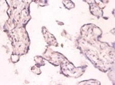 PKMYT1 Antibody - Immunohistochemistry of paraffin-embedded human placenta tissue at dilution 1:100