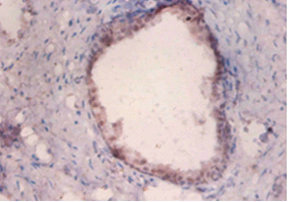 PKMYT1 Antibody - Immunohistochemistry of paraffin-embedded human prostate tissue at dilution 1:100