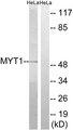 PKMYT1 Antibody - Western blot analysis of extracts from HeLa cells, using MYT1 (Ab-83) antibody.