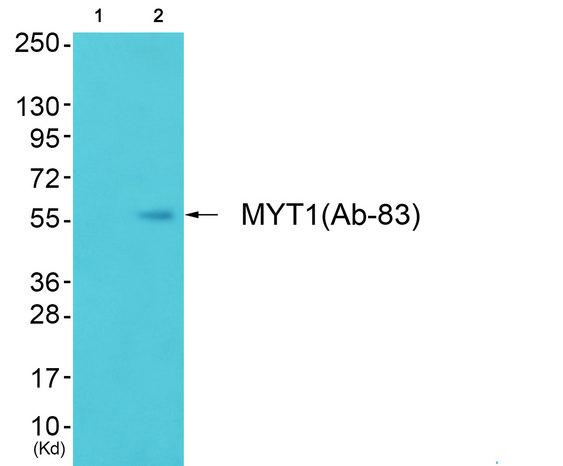 PKMYT1 Antibody - Western blot analysis of extracts from COLO cells, using MYT1 (Ab-83) antibody.