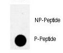 PKMYT1 Antibody - Dot blot of anti-Phospho-MYT1-T495 Antibody on nitrocellulose membrane. 50ng of Phospho-peptide or Non Phospho-peptide per dot were adsorbed. Antibody working concentrations are 0.5ug per ml.