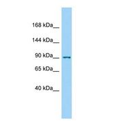 PKN1 Antibody - Western blot of Rat Thymus. Pkn1 antibody dilution 1.0 ug/ml.  This image was taken for the unconjugated form of this product. Other forms have not been tested.