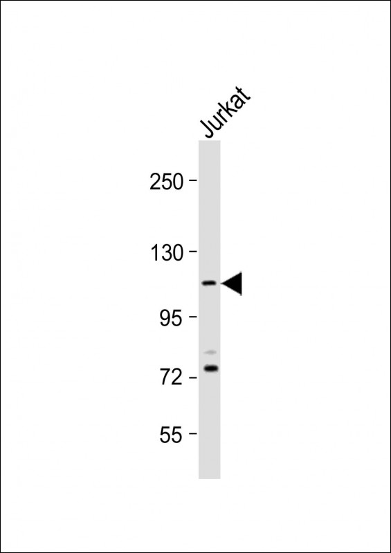 PKN1 Antibody - Anti-PKN1 Antibody (C-Term) at 1:2000 dilution + Jurkat whole cell lysate Lysates/proteins at 20 µg per lane. Secondary Goat Anti-Rabbit IgG, (H+L), Peroxidase conjugated at 1/10000 dilution. Predicted band size: 104 kDa Blocking/Dilution buffer: 5% NFDM/TBST.