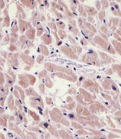 PKN1 Antibody - PKN1 Antibody (C-Term) staining PKN1 in human heart tissue sections by Immunohistochemistry (IHC-P - paraformaldehyde-fixed, paraffin-embedded sections). Tissue was fixed with formaldehyde and blocked with 3% BSA for 0. 5 hour at room temperature; antigen retrieval was by heat mediation with a citrate buffer (pH6). Samples were incubated with primary antibody (1/25) for 1 hours at 37°C. A undiluted biotinylated goat polyvalent antibody was used as the secondary antibody.