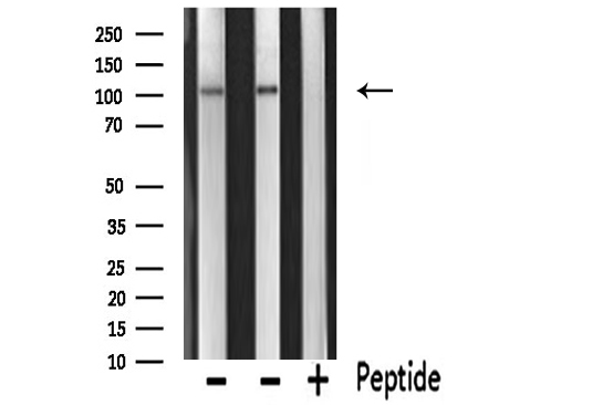 PKN1 Antibody - Western blot analysis of PKN1/PRK1 expression in various lysates