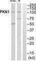 PKN1 Antibody - Western blot analysis of extracts from Jurkat/HuvEc cells, using PKN1/PRK1 antibody.