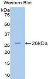 PKN2 Antibody - Western blot of recombinant PKN2 / Pak-2.  This image was taken for the unconjugated form of this product. Other forms have not been tested.