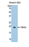 PKN2 Antibody - Western blot of recombinant PKN2 / Pak-2.  This image was taken for the unconjugated form of this product. Other forms have not been tested.