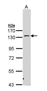 PKN2 Antibody - Sample (30 ug of whole cell lysate). A: H1299. 7.5% SDS PAGE. PKN2 / Pak-2 antibody diluted at 1:1000.