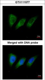 PKN2 Antibody - Immunofluorescence of paraformaldehyde-fixed HeLa using protein kinase N2 antibody at 1:200 dilution.