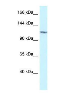 PKN2 Antibody - PKN2 antibody Western blot of 293T Cell lysate. Antibody concentration 1 ug/ml.  This image was taken for the unconjugated form of this product. Other forms have not been tested.