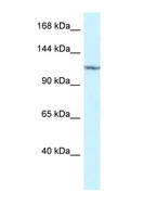 PKN2 Antibody - PKN2 antibody Western blot of 293T Cell lysate. Antibody concentration 1 ug/ml.  This image was taken for the unconjugated form of this product. Other forms have not been tested.
