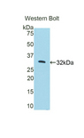 PKN2 Antibody - Western blot of recombinant PKN2 / Pak-2.  This image was taken for the unconjugated form of this product. Other forms have not been tested.