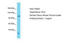 PKN2 Antibody -  This image was taken for the unconjugated form of this product. Other forms have not been tested.
