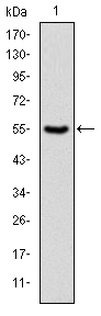 PKN2 Antibody - Western blot using PRK2 monoclonal antibody against human PRK2 (AA: 555-718) recombinant protein. (Expected MW is 43.9 kDa)