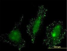 PKN2 Antibody - Immunofluorescence of monoclonal antibody to PKN2 on HeLa cell . [antibody concentration 10 ug/ml]