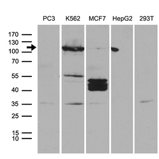 PKN3 Antibody - Western blot analysis of extracts. (35ug) from 5 different cell lines by using anti-PKN3 monoclonal antibody. (1:500)