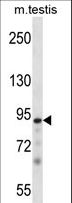 PKN3 Antibody - Mouse Pkn3 Antibody western blot of mouse testis tissue lysates (35 ug/lane). The Pkn3 antibody detected the Pkn3 protein (arrow).