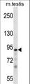 PKN3 Antibody - Mouse Pkn3 Antibody western blot of mouse testis tissue lysates (35 ug/lane). The Pkn3 antibody detected the Pkn3 protein (arrow).