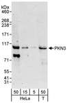 PKN3 Antibody - Detection of Human PKN3 by Western Blot. Samples: Whole cell lysate from HeLa (5, 15 and 50 ug) and 293T (T; 50 ug) cells. Antibodies: Affinity purified rabbit anti-PKN3 antibody used for WB at 0.1 ug/ml. Detection: Chemiluminescence with an exposure time of 30 seconds.