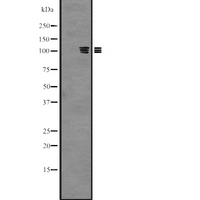 PKN3 Antibody - Western blot analysis of PKN3 expression in HeLa cells lysate. The lane on the left is treated with the antigen-specific peptide.