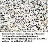 PKNOX1 / PREP1 Antibody
