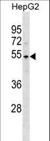 PKNOX1 / PREP1 Antibody - PKNOX1 Antibody western blot of HepG2 cell line lysates (35 ug/lane). The PKNOX1 antibody detected the PKNOX1 protein (arrow).