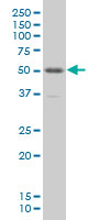 PKNOX1 / PREP1 Antibody - PKNOX1 monoclonal antibody (M01), clone 4F6 Western Blot analysis of PKNOX1 expression in IMR-32.