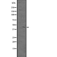 PKNOX1 / PREP1 Antibody - Western blot analysis of PKNOX1 expression in A431 whole cells lysate. The lane on the left is treated with the antigen-specific peptide.