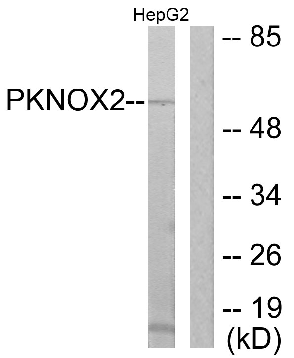 PKNOX2 Antibody - Western blot analysis of lysates from HepG2 cells, using PKNOX2 Antibody. The lane on the right is blocked with the synthesized peptide.