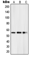 PKNOX2 Antibody - Western blot analysis of PKNOX2 expression in HeLa (A); mouse kidney (B); rat kidney (C) whole cell lysates.