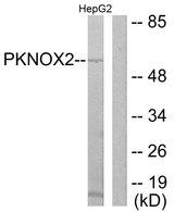 PKNOX2 Antibody - Western blot analysis of extracts from HepG2cells, using PKNOX2 antibody.
