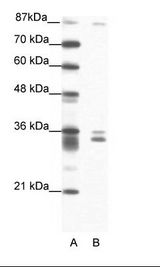 PKNOX2 Antibody - A: Marker, B: Jurkat Cell Lysate.  This image was taken for the unconjugated form of this product. Other forms have not been tested.
