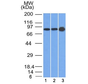 PKP1 / Plakophilin 1 Antibody - Western blot testing of human 1) U87, 2) HeLa and 3) A431 cell lysate with Plakophilin 1 antibody (clone 10B2). Expected molecular weight: 75-83 kDa.