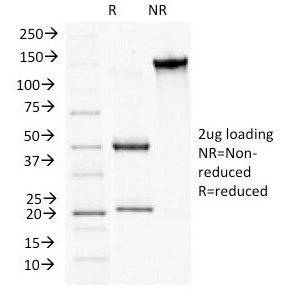 PKP1 / Plakophilin 1 Antibody - SDS-PAGE Analysis of Purified, BSA-Free Plakophilin 1 Antibody (clone 10B2). Confirmation of Integrity and Purity of the Antibody.