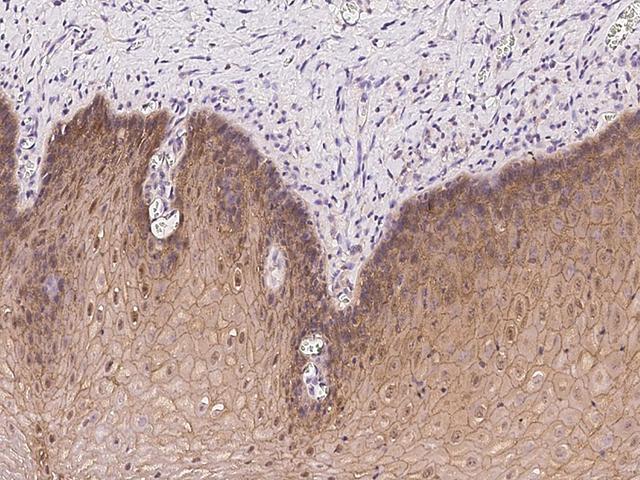 PKP1 / Plakophilin 1 Antibody - Immunochemical staining of human PKP1 in human esophagus with rabbit polyclonal antibody at 1:100 dilution, formalin-fixed paraffin embedded sections.