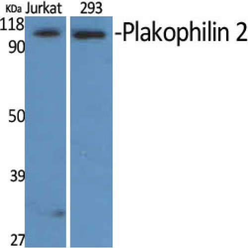 PKP2 / Plakophilin 2 Antibody - Western blot of Plakophilin 2 antibody