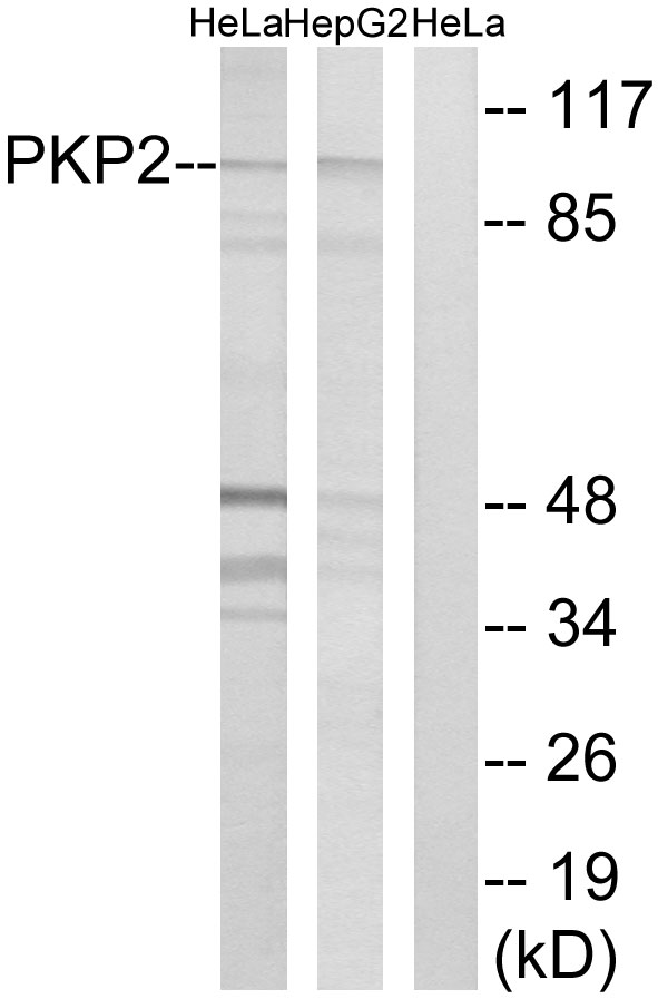 PKP2 / Plakophilin 2 Antibody - Western blot analysis of lysates from HeLa and HepG2 cells, using PKP2 Antibody. The lane on the right is blocked with the synthesized peptide.