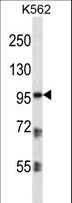 PKP2 / Plakophilin 2 Antibody - PKP2 Antibody western blot of K562 cell line lysates (35 ug/lane). The PKP2 antibody detected the PKP2 protein (arrow).