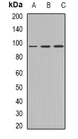 PKP2 / Plakophilin 2 Antibody - Western blot analysis of Plakophilin 2 expression in Jurkat (A); HepG2 (B); HEK293T (C) whole cell lysates.
