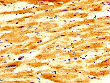 PKP2 / Plakophilin 2 Antibody - Immunohistochemistry image at a dilution of 1:200 and staining in paraffin-embedded human heart tissue performed on a Leica BondTM system. After dewaxing and hydration, antigen retrieval was mediated by high pressure in a citrate buffer (pH 6.0) . Section was blocked with 10% normal goat serum 30min at RT. Then primary antibody (1% BSA) was incubated at 4 °C overnight. The primary is detected by a biotinylated secondary antibody and visualized using an HRP conjugated SP system.