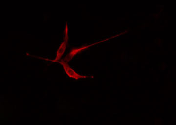 PKP2 / Plakophilin 2 Antibody - Staining HeLa cells by IF/ICC. The samples were fixed with PFA and permeabilized in 0.1% Triton X-100, then blocked in 10% serum for 45 min at 25°C. The primary antibody was diluted at 1:200 and incubated with the sample for 1 hour at 37°C. An Alexa Fluor 594 conjugated goat anti-rabbit IgG (H+L) antibody, diluted at 1/600, was used as secondary antibody.