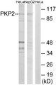 PKP2 / Plakophilin 2 Antibody - Western blot analysis of extracts from HeLa cells and HepG2 cells, using PKP2 antibody.