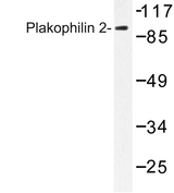 PKP2 / Plakophilin 2 Antibody - Western blot of Plakophilin 2 (P663) pAb in extracts from HeLa cells.