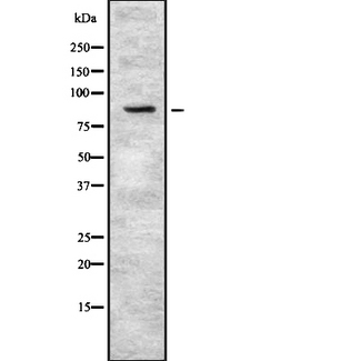 PKP3 / Plakophilin 3 Antibody - Western blot analysis of PKP3 using K562 whole cells lysates