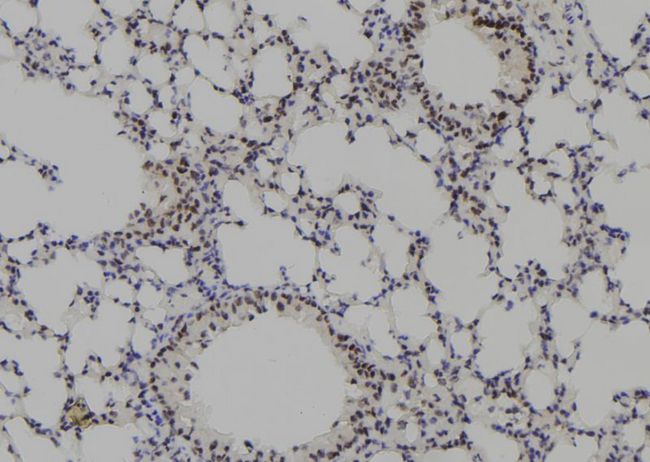 PKP3 / Plakophilin 3 Antibody - 1:100 staining mouse lung tissue by IHC-P. The sample was formaldehyde fixed and a heat mediated antigen retrieval step in citrate buffer was performed. The sample was then blocked and incubated with the antibody for 1.5 hours at 22°C. An HRP conjugated goat anti-rabbit antibody was used as the secondary.