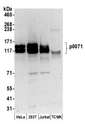 PKP4 / Plakophilin 4 Antibody - Detection of human p0071 by western blot. Samples: Whole cell lysate (50 µg) from HeLa, HEK293T, Jurkat and mouse TCMK-1 cells prepared using NETN lysis buffer. Antibodies: Affinity purified rabbit anti-p0071 antibody used for WB at 0.1 µg/ml. Detection: Chemiluminescence with an exposure time of 3 minutes.