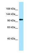 PKP4 / Plakophilin 4 Antibody - PKP4 / Plakophilin 4 antibody Western Blot of HeLa.  This image was taken for the unconjugated form of this product. Other forms have not been tested.