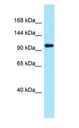 PKP4 / Plakophilin 4 Antibody - PKP4 / Plakophilin 4 antibody Western Blot of HeLa.  This image was taken for the unconjugated form of this product. Other forms have not been tested.